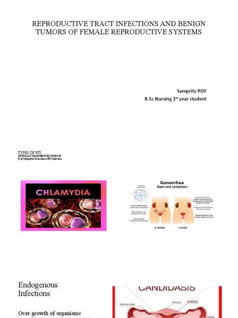 Reproductive Tract Infection Pdf Uterus Vagina