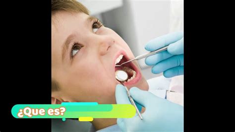 Gingivitis Para Niños Youtube