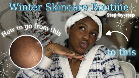 My Holy Grail Step By Step Winter Skincare Routine That Cleared My Skin