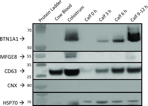 Protein Expression Analysis Of Evs Of Colostral And Blood Evs From