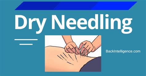 How Effective is Dry Needling For Pain Relief