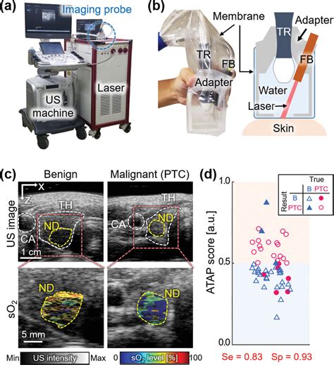 Recent Advances In Ultrasound And Photoacoustic Analysis For Thyroid