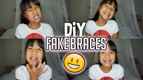 Diy fake braces kit | Anime Telegram