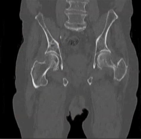 Imaging Diagnosis And Follow Up Of Advanced Prostate Cancer Clinical Perspectives And State Of