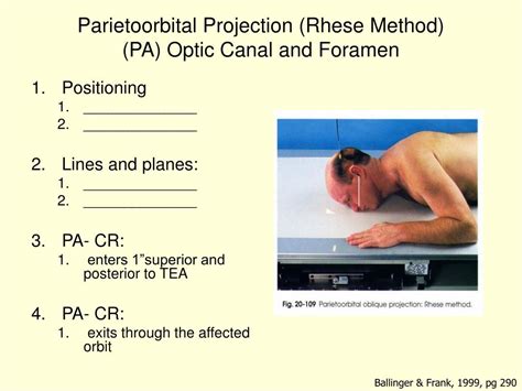 Ppt Radiography Of The Orbits Powerpoint Presentation Id318479