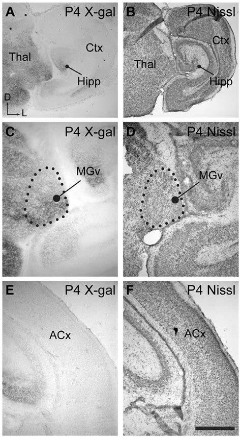 Expression Of EphB2 In Auditory Pathways At P4 A Low Power View Of