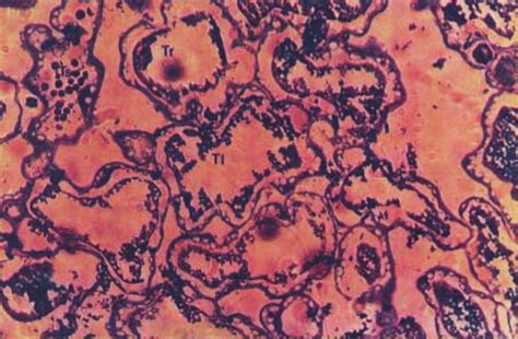 Micrograph of mesophyll cells (type I, II and III) on the cross-section ...