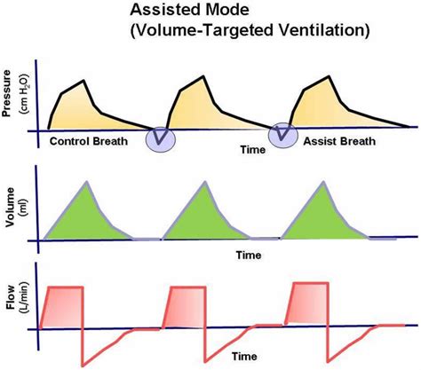 Mechanical Ventilation Types Indications Complications Settings And Modes