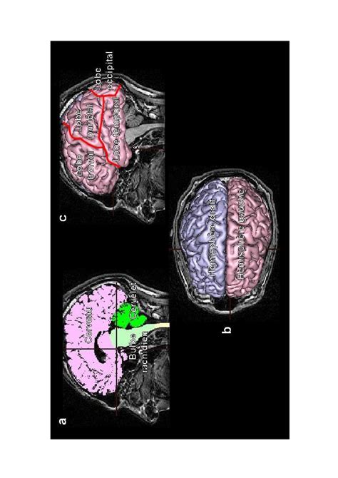 Chapitre 2 Cerveau et vision aires cérébrales et plasticité