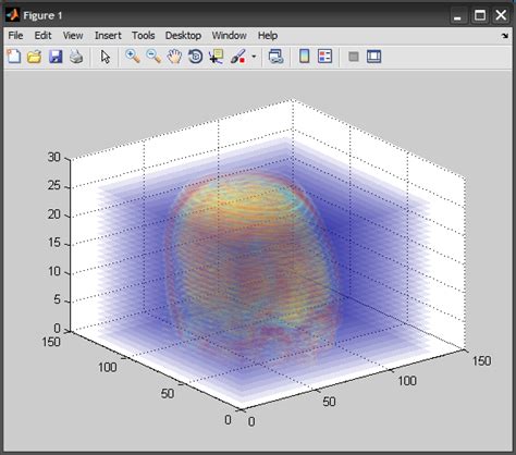 Matlab 3d Dose Array Visualization Stack Overflow