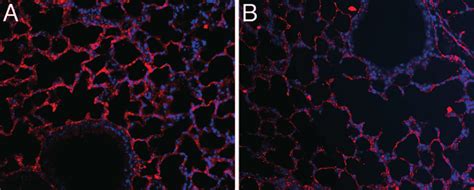 Immunofluorscence Staining For Caveolin 1 Shows Down Regulation Of This