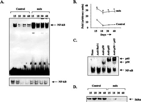 Activation Of Nf B In Mdx Mice A Level Of Nf B Dna Binding