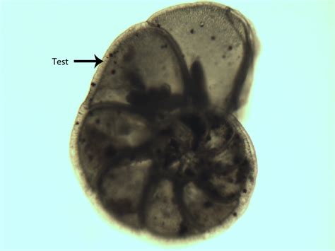 Foraminiferans - Dr. Peat's Biology Page