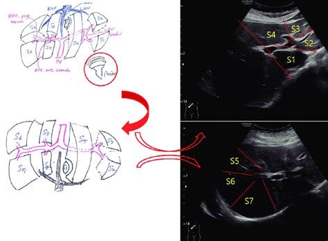 ultrasonographic imaging   liver  couinauds segmental
