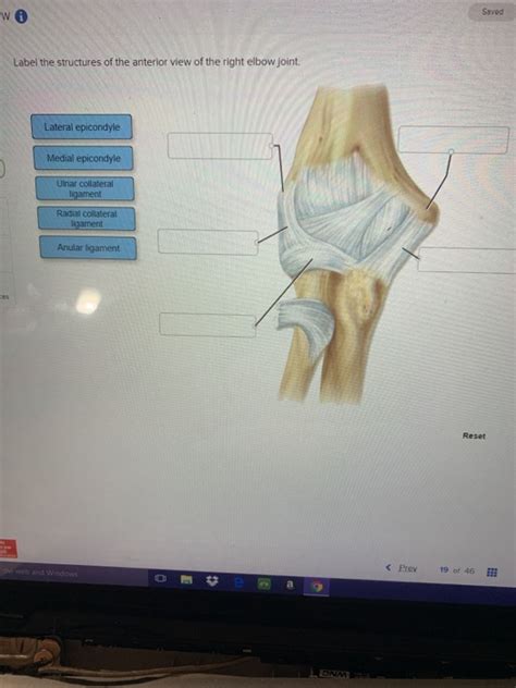 Solved Saved W Label The Structures Of The Anterior View Of Chegg