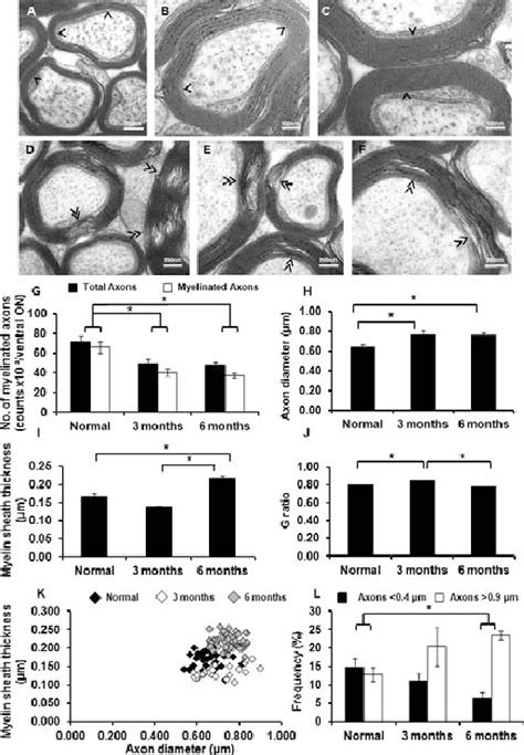 Representative Tem Images And Quantification Of The Number Diameter