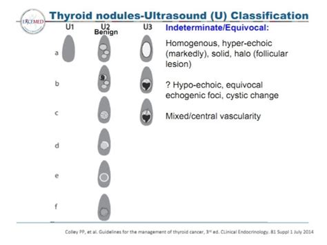 Thyroid Nodules And Cancer