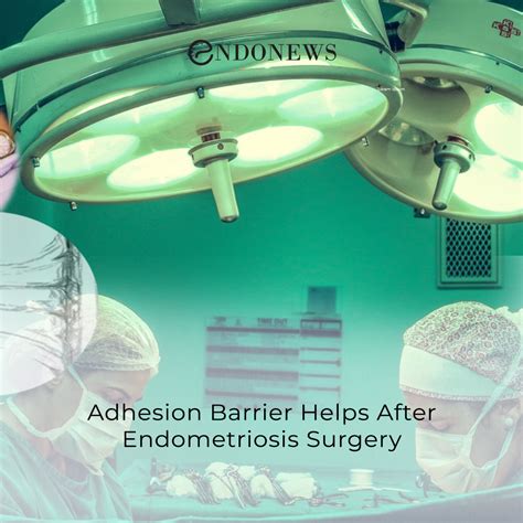 Adhesion Barrier Helps After Endometriosis Surgery | EndoNews