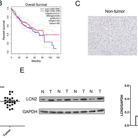 Lcn Induced Activation Of Jak Stat Signaling Pathway In Hcc Cells