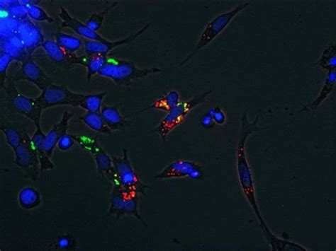 Invitrogen Low Density Lipoprotein From Human Plasma Phrodo Green