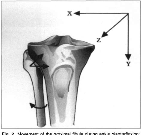 Figure From The Mobility Of The Proximal Tibio Fibular Joint A