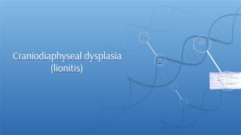 Craniodiaphyseal dysplasia by Amira Donahue on Prezi