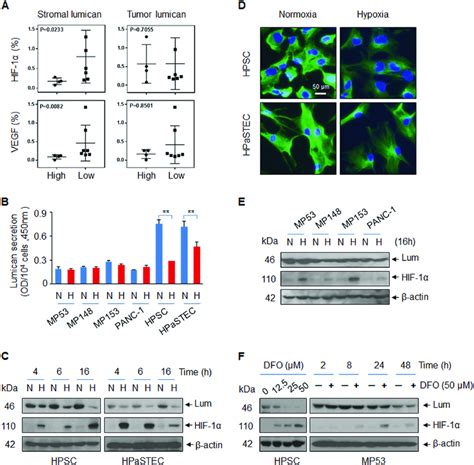 Hypoxia Downregulates Lumican In Stellate Cells But Not In Cancer