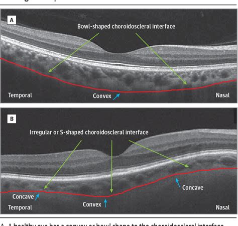 Figure 2 From Analysis Of Morphological Features And Vascular Layers Of