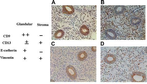 Stem Cells In Human Normal Endometrium And Endometrial Cancer Cells