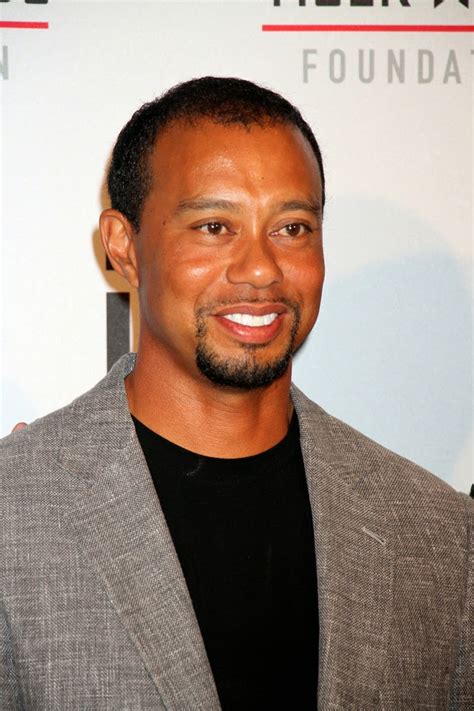 Celebrity Hair Loss Why Tiger Woods Is Wrong About His Hair Loss