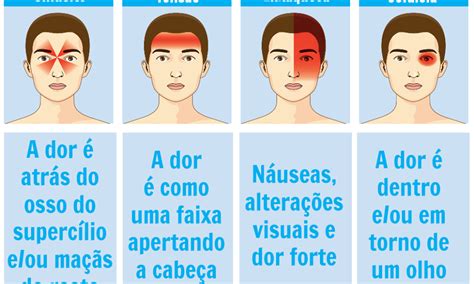 Conheça Os Tipos De Dores De Cabeça Qual é A Sua Blog Do Raoni