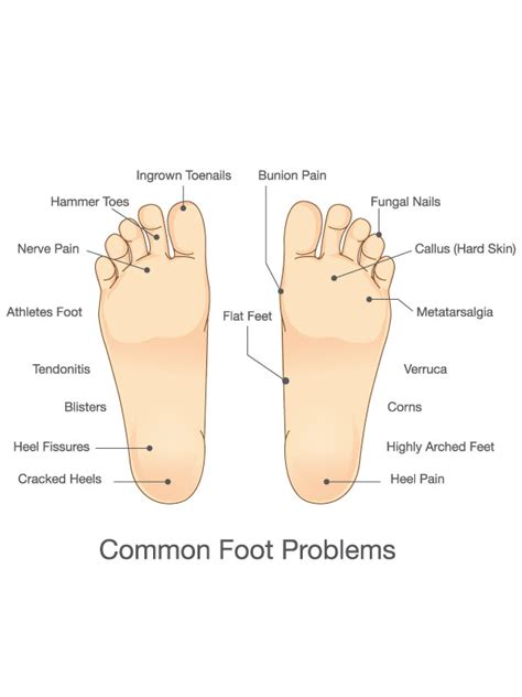 Basic Foot Care - MVS Podiatry Associates