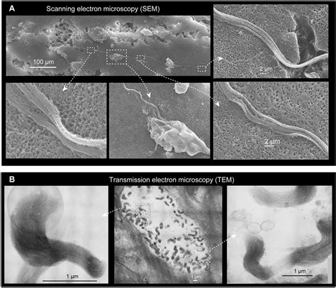 Figures And Data In Epidermal Threads Reveal The Origin Of Hagfish