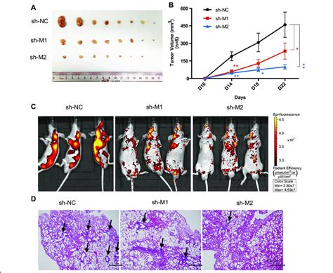 Malat1 Promotes Hcc Tumor Growth And Metastasis In Vivo A Subcutaneous