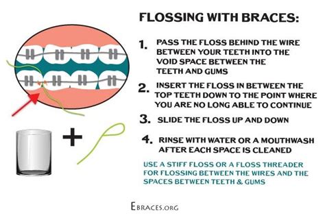 How to Floss with Braces and Help Your Teeth Look Better