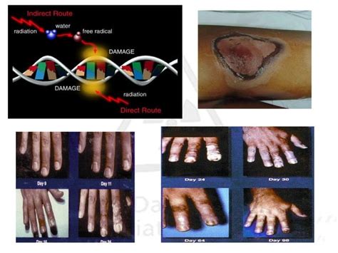 Radioactive pollution | PPT