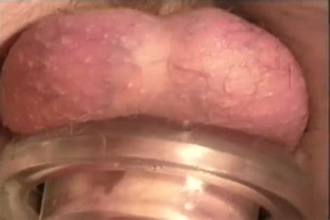 Sunshine Gay Porn Videos At Boy 18 Tube