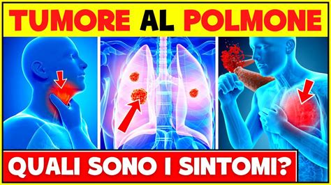 Segni E Sintomi Di Un Tumore Ai Polmoni Non Ignorare Questi Sintomi