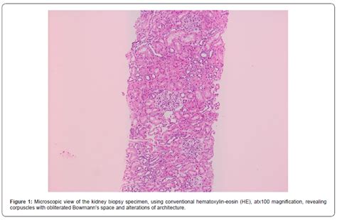 Variability Of Clinical And Paraclinical Manifestations In