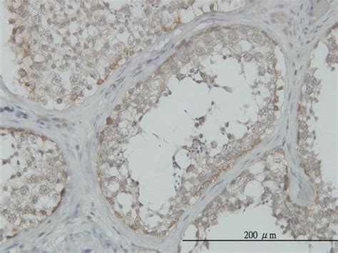 Monoclonal Anti Map K Antibody Produced In Mouse