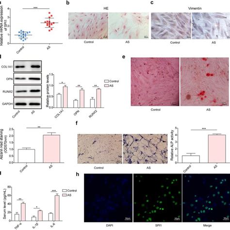 Knockdown Of Spi Inhibits Osteogenic Differentiation Of As