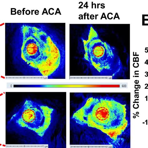 Post Treatment With PYY3 36 Inhibited Microglial Activation And