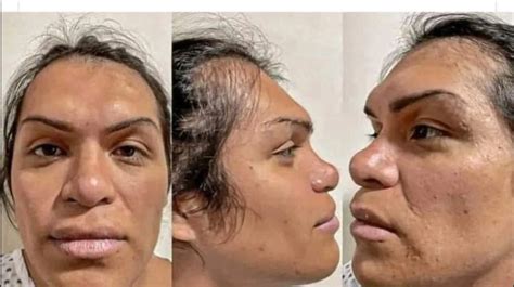 Filtran fotos de Wendy Guevara sin maquillaje ni filtros antes de cirugías