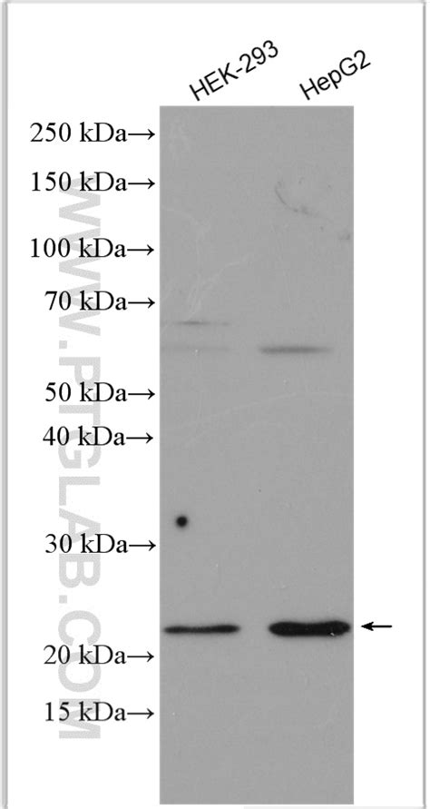 Claudin 2 Antibody 26912 1 Ap Proteintech 武汉三鹰生物技术有限公司