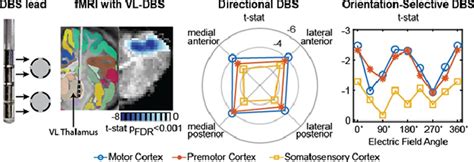 Orientation Selective And Directional Deep Brain Stimulation In Swine Assessed By Functional Mri