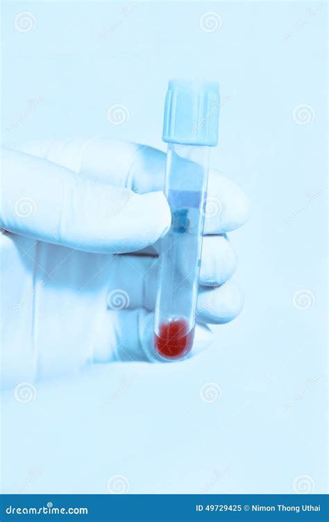 Hand Holding Blood In Test Tube Take With Blue Filter Stock Image