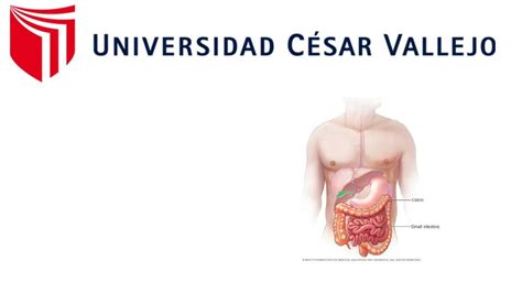 Obstrucci N Intestinal Alta Por Adherencias Caso Clinico Middlemedic