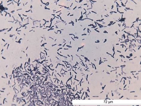 Clostridium Tetani Symptoms