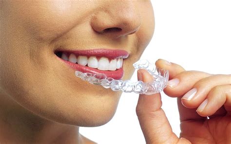 Invisalign And Eating Here S What You Should Know Life Discussion