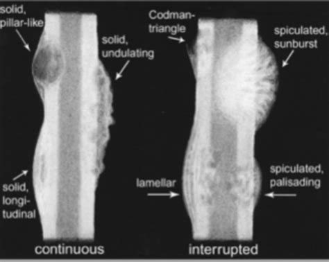 Msk Imaging Flashcards Quizlet